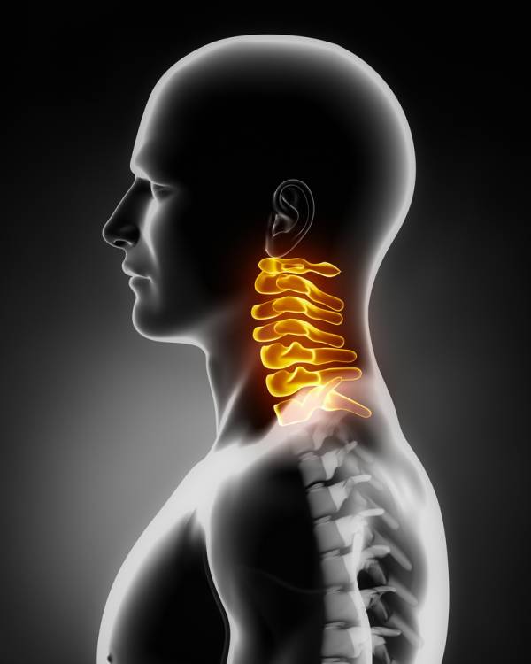 cervical spine, cervical injury, neck injury, bjj injury