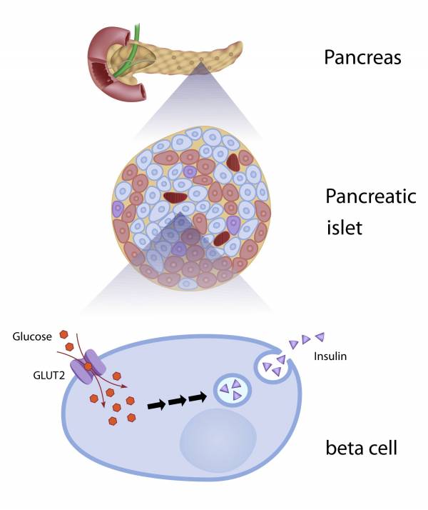 insulin, insulin response, metabolic disease, metabolic flexibility, glucose