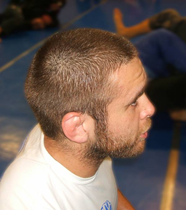 cauliflower ear, headgear, bjj, cauli ear, treating cauliflower ear