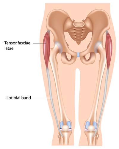 it band, foam rolling, TFL, hip abduction, gluteus medius