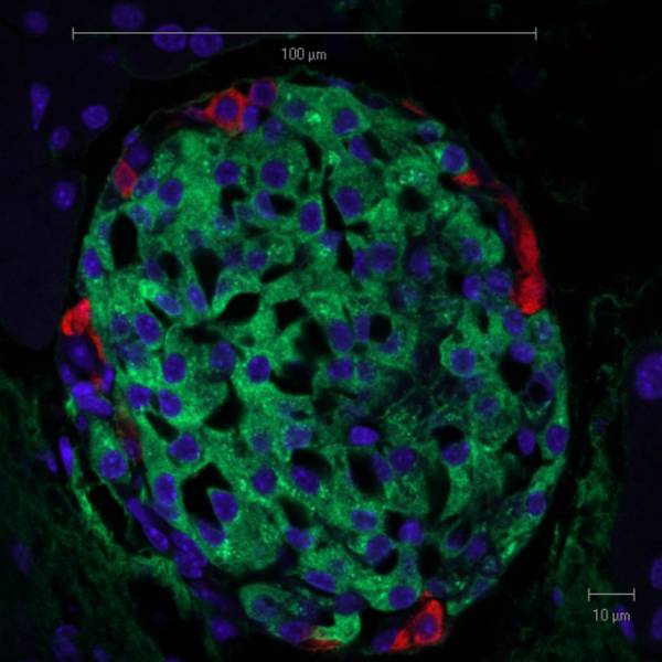 beta cells producing insulin on an islet in a mouse pancreas