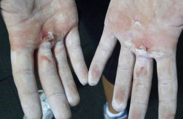 crossfit dangers, dangers of crossfit, crossfit controversy, crossfit injury