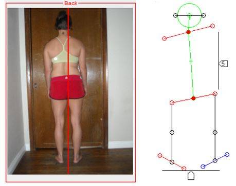 physical alignment therapy, maryann berry, physical therapy, alignment