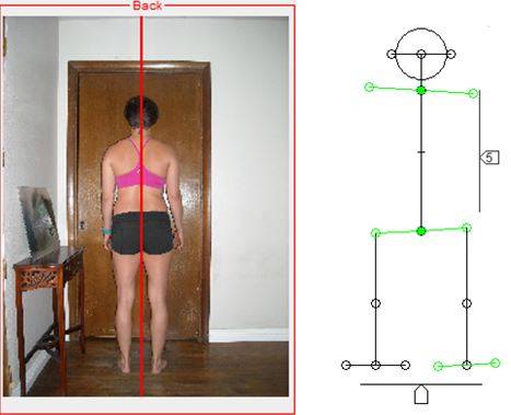 alignment, posture alignment therapy, maryann berry, egoscue