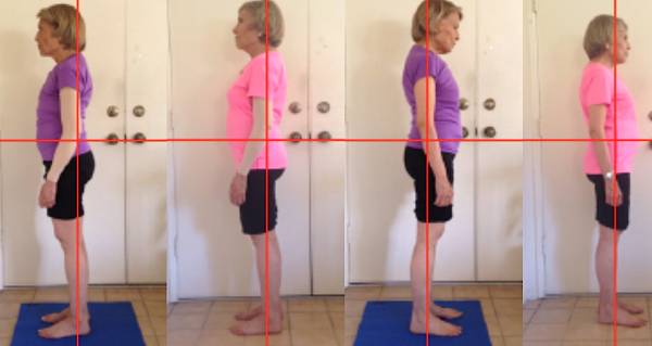 posture alignment therapy, TMJ, posture