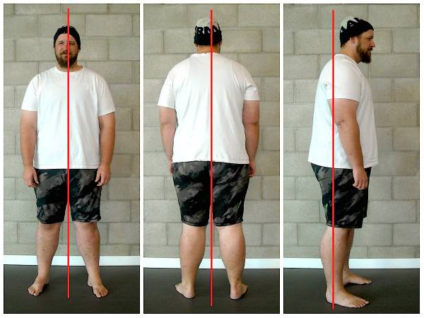 Joe’s initial posture pictures provide us with examples of common compensations.