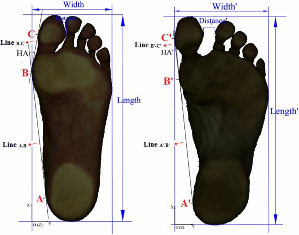 natural versus restricted position of the big toe