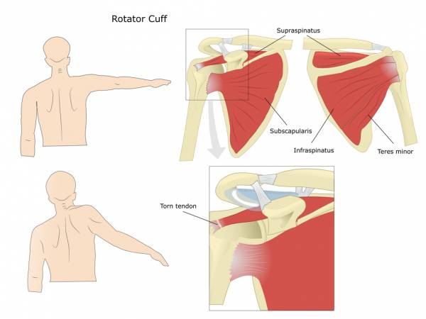 The shoulder joint is one of the most vulnerable joints in the human body.