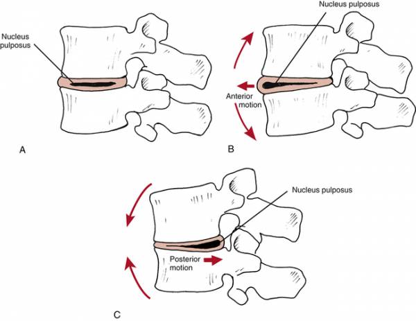 Positions for potential injury.