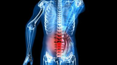 nerve pain, neuropathic pain, sciatic pain, back pain, nerve damage