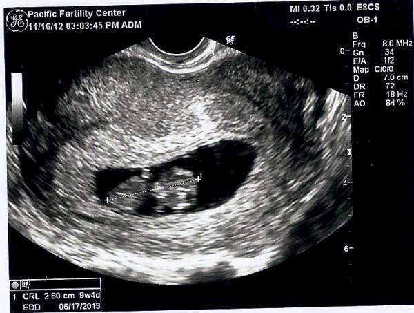 Pregnant Athlete Journal, Week 10: Happy Baby Heartbeat - Breaking Muscle