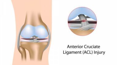 acl injury, knee injury, acl injury menstrual cycle, menstrual cycle injury