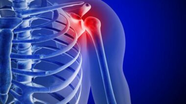 shoulder pain, shoulder instability, shoulder injury, shoulder muscles