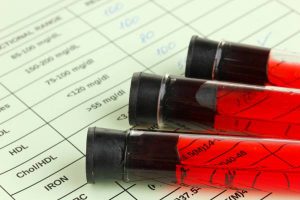 ben greenfield, blood tests, blood tests for athletes, athletes and blood tests