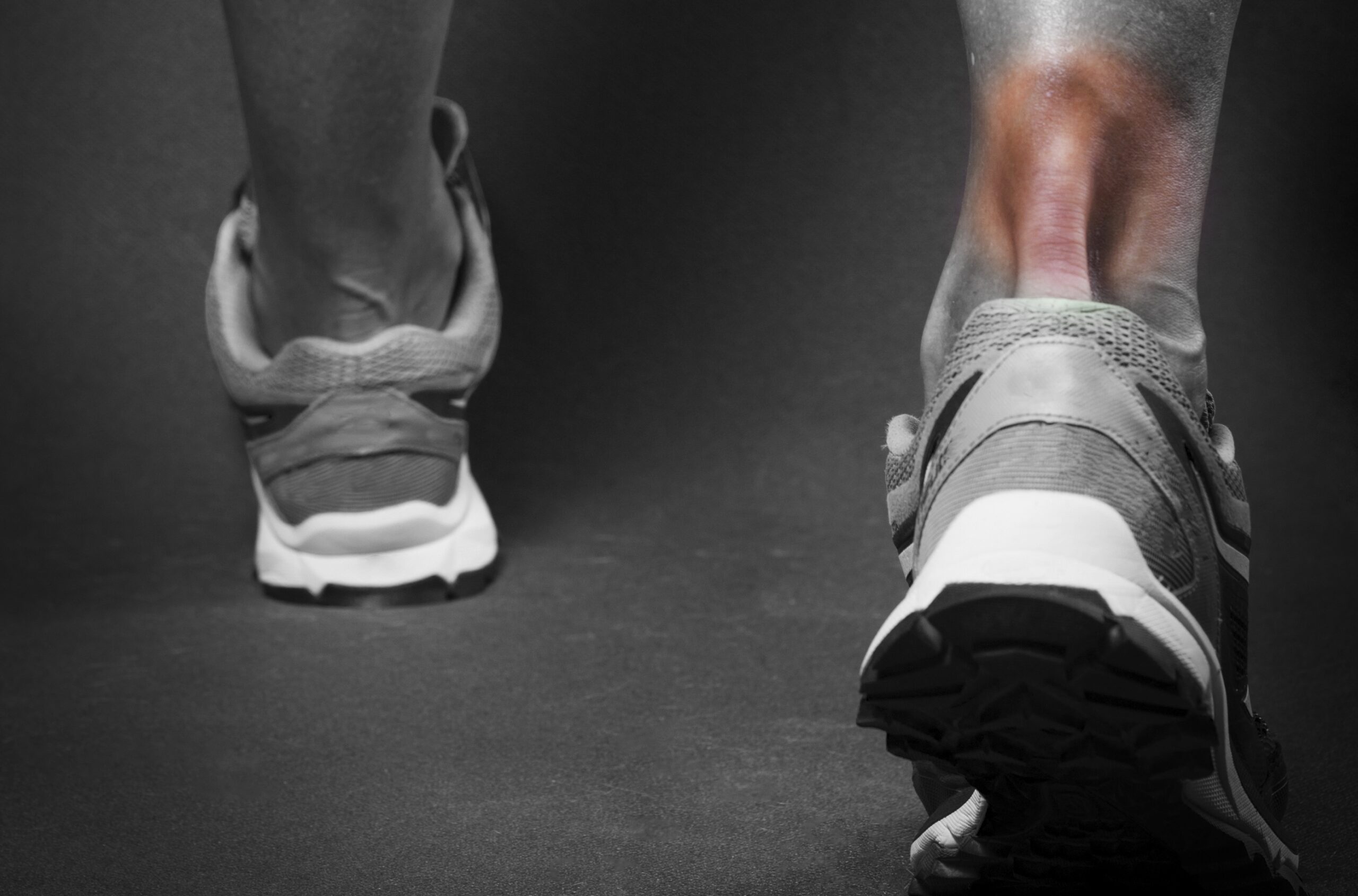 The Curse of Achilles How to Prevent and Heal Achilles Tendon Injuries