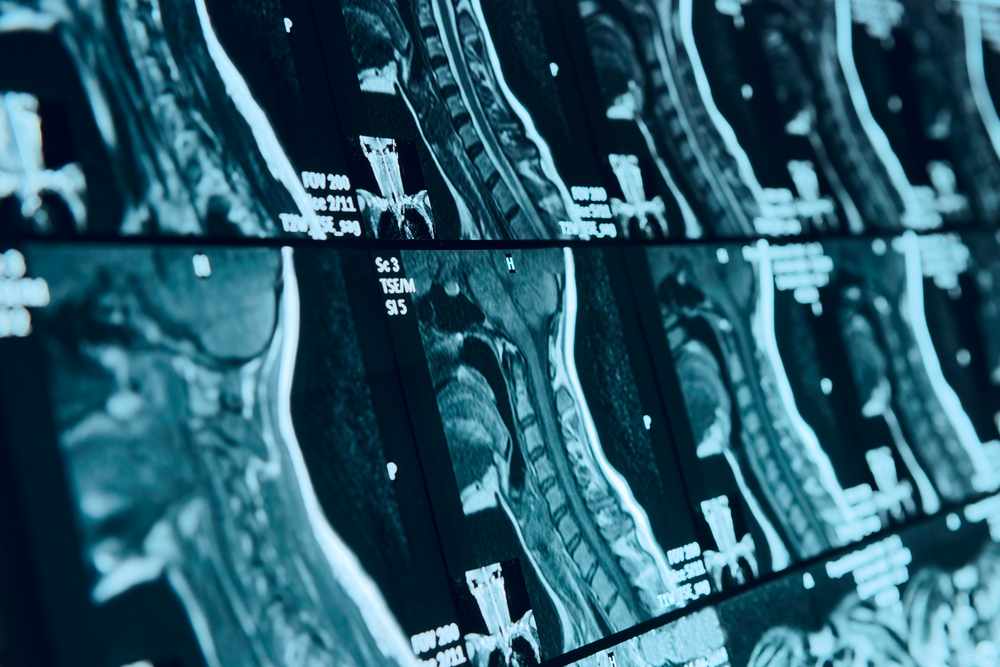 Dynamic Can A Physical Therapist Order An Mri Abstract for Your Screen Dynamic Can A Physical Therapist Order An Mri Abstract for Your Screen